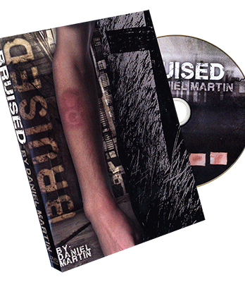 Bruised by Daniel Martin  - Trick