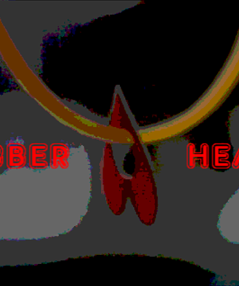 Rubber Heart by Arnel Renegado video DOWNLOAD
